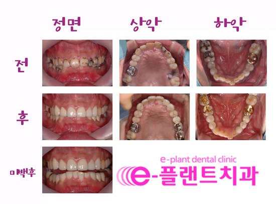 e-플랜트치과 이미지