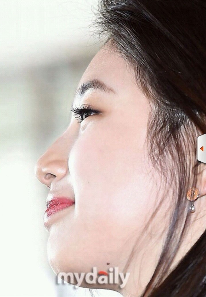 피부가 안좋으면 망하기 쉬운 극단적 클로즈업 | 인스티즈
