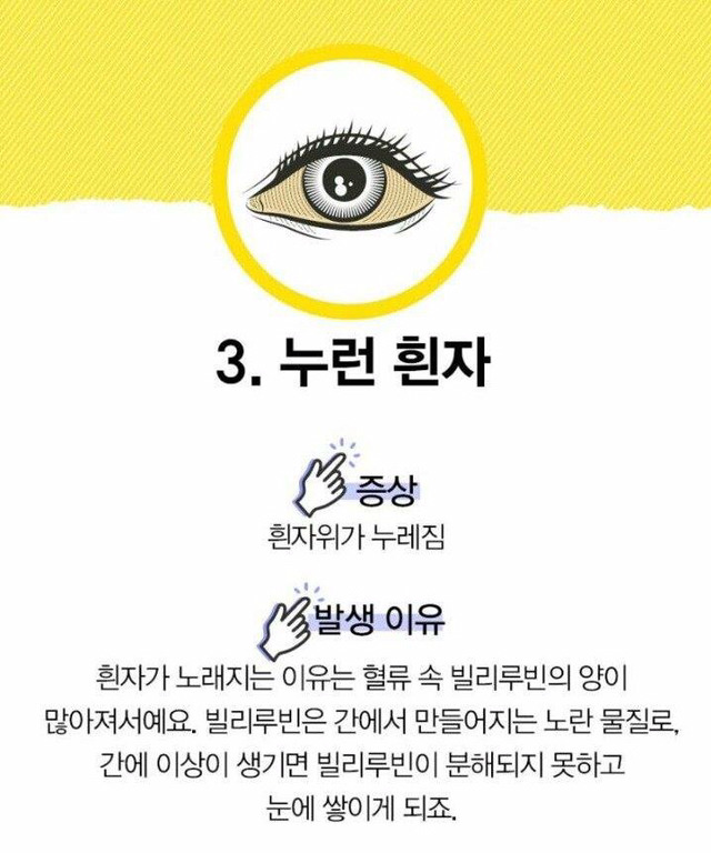 눈으로 알 수 있는 질병 | 인스티즈