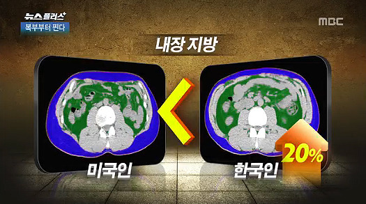 침묵의 암살자 뱃속의 시한폭탄 내장지방의 위험성 | 인스티즈