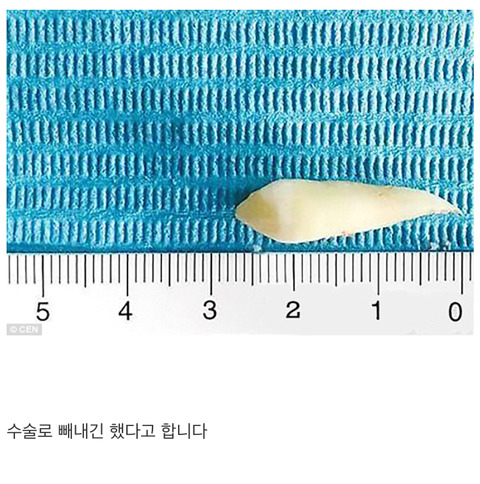 환자랑 의사랑 서로 대화가 안통함.jpg | 인스티즈