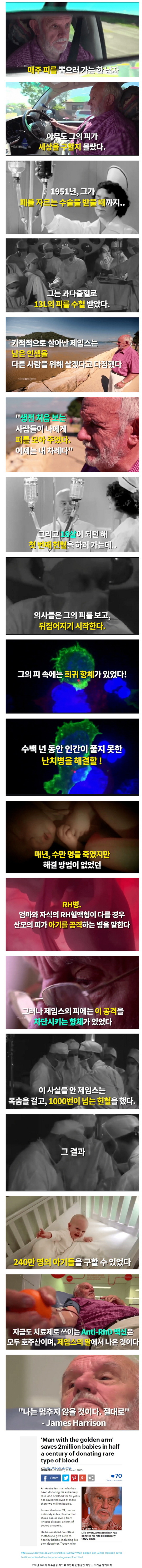 한 사람의 팔로 구한 240만의 생명 | 인스티즈